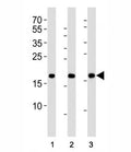 Western blot analysis of lysate from HepG2, NCCIT, mouse NIH3T3 cell line (left to right) using HMGA2 antibody; Ab was diluted at 1:1000 for each lane. Predicted molecular weight ~12kDa but routinely observed at ~18kDa.