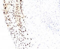 IHC testing of FFPE human cervix with HPV-16 L1 antibody (clone MCAPL1). FFPE testing requires sections to be boiled in pH 9 10mM Tris with 1mM EDTA for 10-20 minutes, followed by cooling at RT for 20 minutes, prior to staining.
