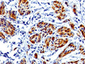 IHC testing of FFPE human uterus with recombinant CAD antibody (clone RMCDN1-1). HIER: steam sections in 10mM Tris with 1mM EDTA, pH9, for 10-20 min.