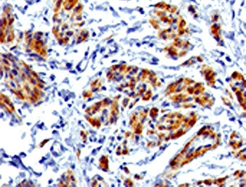 IHC testing of FFPE human uterus with recombinant CAD antibody (clone RMCDN1-1). HIER: steam sections in 10mM Tris with 1mM EDTA, pH9, for 10-20 min.