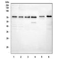 Western blot testing of 1) human HaCaT, 2) human A431, 3) human A549, 4) human MCF7, 5) rat C6 and 6) mouse Neuro-2a cell lysate with BDKRB2 antibody at 0.5ug/ml. Predicted molecular weight ~44 kDa but may be observed at higher molecular weights due to glycosylation.