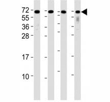 Western blot testing of CD63 antibody at 1:2000 dilution. Lane 1: A2058 lysate; 2: A375 lysate; 3: THP-1 lysate; 4: U-87 MG lysate; Predicted molecular weight: 25-60 kDa depending on glycosylation level.