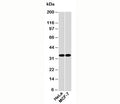 Western blot testing of human samples with EMAP II antibody at 2ug/ml. Predicted molecular weight: ~34/37kDa (isoforms 1/2).