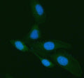 Immunofluorescent staining of Galectin-3/LGALS3 using anti-LGALS3 antibody (green). Galectin-3/LGALS3 was detected in an immunocytochemical section of HELA cells. Enzyme antigen retrieval was performed using IHC enzyme antigen retrieval reagent for 15 mins. The cells were blocked with 10% goat serum. And then incubated with 5 ug/ml rabbit anti-LGALS3 antibody overnight at 4oC. DyLight 488 Conjugated Goat Anti-Rabbit IgG was used as secondary antibody at 1:500 dilution and incubated for 30 min at 37oC.
