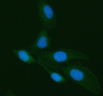 Immunofluorescent staining of Galectin-3/LGALS3 using anti-LGALS3 antibody (green). Galectin-3/LGALS3 was detected in an immunocytochemical section of HELA cells. Enzyme antigen retrieval was performed using IHC enzyme antigen retrieval reagent for 15 mins. The cells were blocked with 10% goat serum. And then incubated with 5 ug/ml rabbit anti-LGALS3 antibody overnight at 4oC. DyLight 488 Conjugated Goat Anti-Rabbit IgG was used as secondary antibody at 1:500 dilution and incubated for 30 min at 37oC.