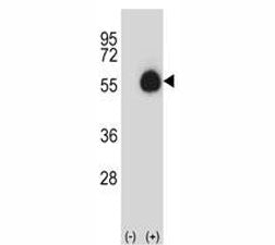 Western blot analysis of CD33 antibody and 293 cell lysate (2 ug/lane) either nontransfected (Lane 1) or transiently transfected (2) with the CD33 gene.