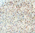 IHC staining of FFPE rat brain tissue with CGRP antibody, HRP-secondary and DAB substrate. HIER: boil tissue sections in pH8 EDTA for 20 min and allow to cool before testing.