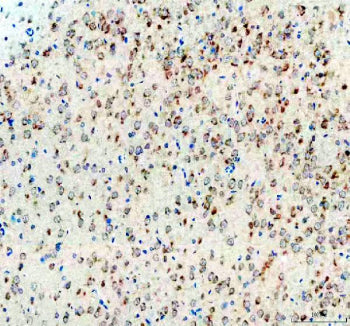 IHC staining of FFPE rat brain tissue with CGRP antibody, HRP-secondary and DAB substrate. HIER: boil tissue sections in pH8 EDTA for 20 min and allow to cool before testing.