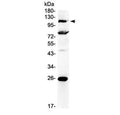 Western blot testing of human 22RV1 cell lysate with NFAT4 antibody at 0.5ug/ml. Predicted molecular weight: ~116 kDa but can be observed at 140~150 kDa due to phosphorylation.
