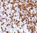 Formalin-fixed, paraffin-embedded human tonsil stained with CD44 antibody (clone HCM15-1). FFPE testing requires sections to be boiled in pH6 10mM citrate buffer for 10-20 minutes, followed by cooling at RT for 20 minutes, prior to staining.