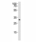 Western blot analysis of lysate from rat liver using Cebpb antibody. Ab was diluted at 1:1000. Predicted molecular weight: ~33/33/36-41 kDa (rat/mouse/human).