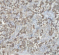 IHC staining of FFPE human testicular germ cell tumor tissue with MYCBP antibody. HIER: boil tissue sections in pH8 EDTA for 20 min and allow to cool before testing.