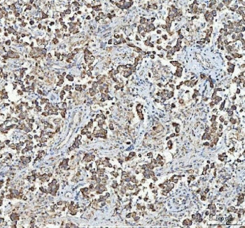 IHC staining of FFPE human testicular germ cell tumor tissue with MYCBP antibody. HIER: boil tissue sections in pH8 EDTA for 20 min and allow to cool before testing.