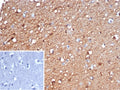IHC staining of FFPE human brain tissue with Gamma Enolase antibody (clone ENO2/6678). Inset: PBS used in place of primary Ab (secondary Ab negative control). HIER: boil tissue sections in pH 9 10mM Tris with 1mM EDTA for 20 min and allow to cool before testing.