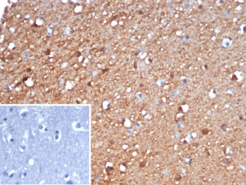 IHC staining of FFPE human brain tissue with Gamma Enolase antibody (clone ENO2/6678). Inset: PBS used in place of primary Ab (secondary Ab negative control). HIER: boil tissue sections in pH 9 10mM Tris with 1mM EDTA for 20 min and allow to cool before testing.