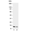 Western blot testing of Resistin antibody and Lane 1: recombinant mouse protein 10ng; 2: 5ng