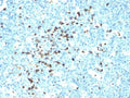 IHC: Formalin-fixed, paraffin-embedded human tonsil stained with IgM antibody (DA4-4)