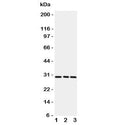 Western blot testing of CD134 / OX40 antibody and rat samples 1: brain; 2: liver; 3: kidney. Expected molecular weight: 29-50 kDa depending on glcyosylation level.