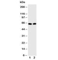 Western blot testing of E2F1 antibody and Lane 1: HeLa; 2: MCF-7 cell lysate. Predicted molecular weight: 48-70 kDa.