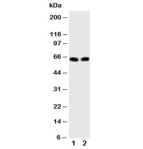 Western blot testing of E2F1 antibody and Lane 1: HeLa; 2: MCF-7 cell lysate. Predicted molecular weight: 48-70 kDa.
