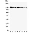 Western blot testing of Vinculin antibody and Lane 1: rat heart; 2: (r) brain; 3: (r) liver; 4: human U87; 5: (h) SMMC-7721; 6: mouse HEPA; 7: (h) HeLa; 8: (h) HT1080 cell lysate. Predicted molecular weight ~124 kDa.