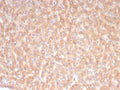 IHC staining of FFPE human liver tissue with 10-Formyltetrahydrofolate dehydrogenase antibody (clone ALDH1L1/7968). HIER: boil tissue sections in pH 9 10mM Tris with 1mM EDTA for 20 min and allow to cool before testing.