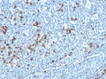 IHC: Formalin-fixed, paraffin-embedded human tonsil stained with Kappa Light Chain antibody (HP6053 + L1C1).