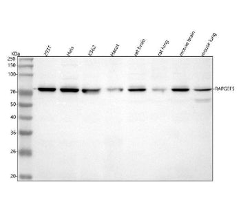 Western blot analysis of RAPGEF5 using anti-RAPGEF5 antibody. Lane 1: human 293T whole cell lysates, Lane 2: human Hela whole cell lysates, Lane 3: human K562 whole cell lysates, Lane 4: human Hacat whole cell lysates, Lane 5: rat brain tissue lysates, Lane 6: rat lung tissue lysates, Lane 7: mouse brain tissue lysates, Lane 8: mouse lung tissue lysates. After electrophoresis, proteins were transferred to a nitrocellulose membrane at 150 mA for 50-90 min.
