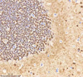 IHC staining of FFPE zebrafish brain tissue with Psmc1 antibody, HRP-labeled secondary and DAB substrate. HIER: boil tissue sections in pH8 EDTA for 20 min and allow to cool before testing.
