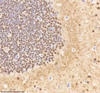 IHC staining of FFPE zebrafish brain tissue with Psmc1 antibody, HRP-labeled secondary and DAB substrate. HIER: boil tissue sections in pH8 EDTA for 20 min and allow to cool before testing.