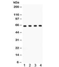 Western blot testing of 1) rat brain, 2) mouse brain, 3) human HeLa and 4) U87 lysate with FE65 antibody. Predicted molecular weight: ~77 kDa; the 97 kDa isoform can be cleaved to yield a 65 kDa C-terminal form.
