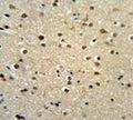 IHC testing of FFPE human brain tissue with Teashirt homolog 2 antibody. HIER: steam section in pH6 citrate buffer for 20 min and allow to cool prior to staining.