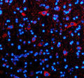 Immunofluorescent staining of TIM10/TIMM10 using anti-TIMM10 antibody (green) and anti-Alpha Tubulin antibody (red). TIM10/TIMM10 was detected in an immunocytochemical section of human A549 cells. Enzyme antigen retrieval was performed using IHC enzyme antigen retrieval reagent for 15 mins. The cells were blocked with 10% goat serum. And then incubated with 5 ug/ml rabbit anti-TIMM10 antibody and mouse anti-Beta Tubulin antibody overnight at 4oC.