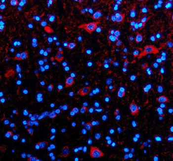 Immunofluorescent staining of TIM10/TIMM10 using anti-TIMM10 antibody (green) and anti-Alpha Tubulin antibody (red). TIM10/TIMM10 was detected in an immunocytochemical section of human A549 cells. Enzyme antigen retrieval was performed using IHC enzyme antigen retrieval reagent for 15 mins. The cells were blocked with 10% goat serum. And then incubated with 5 ug/ml rabbit anti-TIMM10 antibody and mouse anti-Beta Tubulin antibody overnight at 4oC.