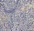 IHC staining of FFPE human tonsil tissue with AIRE antibody. HIER: boil tissue sections in pH8 EDTA for 20 min and allow to cool before testing.