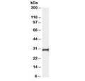 Western blot testing of human thymus lysate with HVEM antibody at 0.03ug/ml. Expected molecular weight: 30-38 kDa depending on glycosylation level.