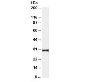 Western blot testing of human thymus lysate with HVEM antibody at 0.03ug/ml. Expected molecular weight: 30-38 kDa depending on glycosylation level.