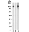 Western blot testing of HEK293 lysate overexpressing CDH11-MYC with CDH11 antibody [1ug/ml] in Lane A and with anti-MYC [1/1000] in lane C. Mock-transfected probed with anti-CDH11 [1ug/ml] in Lane B. Predicted molecular weight: ~88kDa but can be observed at 120-130kDa.