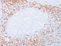 IHC: Formalin-fixed, paraffin-embedded human tonsil stained with CD8a antibody (C8/468 + C8/144B).