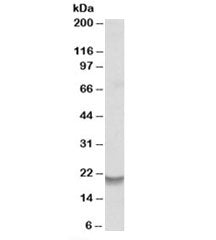 Western blot testing of human bone marrow lysate with Bcl2A1 antibody at 0.2ug/ml. Predicted molecular weight: ~20kDa but may be observed at up to ~37kDa.