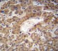 CXCL12 antibody immunohistochemistry analysis in formalin fixed and paraffin embedded human liver tissue.