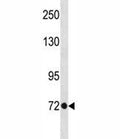 TBR2 antibody western blot analysis in A375 lysate. Observed molecular weight: 73-85 kDa.