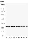 Western blot testing of SOD2 antibody and Lane 1: rat liver; 2: (r) intestine; 3: (r) lung; 4: (r) heart; 5: human SMMC-7721; 6: (h) HeLa; 7: (h) COLO320; 8: (h) SW620; 9: (h) A549 cell lysate. Predicted molecular weight ~ 25 kDa.