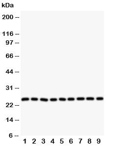Western blot testing of SOD2 antibody and Lane 1: rat liver; 2: (r) intestine; 3: (r) lung; 4: (r) heart; 5: human SMMC-7721; 6: (h) HeLa; 7: (h) COLO320; 8: (h) SW620; 9: (h) A549 cell lysate. Predicted molecular weight ~ 25 kDa.