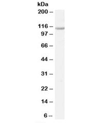 Western blot testing of K562 cell lysate with VDP p115 antibody at 0.3ug/ml. Predicted molecular weight: ~108 kDa but routinely observed at 108~115 kDa.