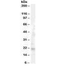 Western blot testing of human liver lysate with FGF21 antibody at 1ug/ml. Predicted molecular weight ~21kDa.