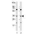 Western blot testing of human 1) K562 and 2) SW620 cell lysate with PIM2 antibody. Predicted molecular weight ~34 kDa.