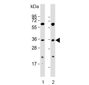 Western blot testing of human 1) K562 and 2) SW620 cell lysate with PIM2 antibody. Predicted molecular weight ~34 kDa.