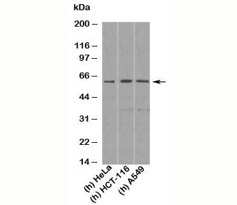 Western blot testing of human samples with KLF4 antibody at 1 ug/ml. Predicted molecular weight: 50-60 kDa + possible ~75 kDa (phosphorylated form).