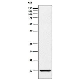 Western blot testing of human recombinant protein with RANTES antibody. Predicted molecular weight ~11 kDa.